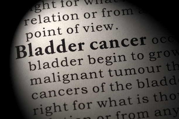 Saiba quais são os fatores de risco do Câncer de Bexiga
