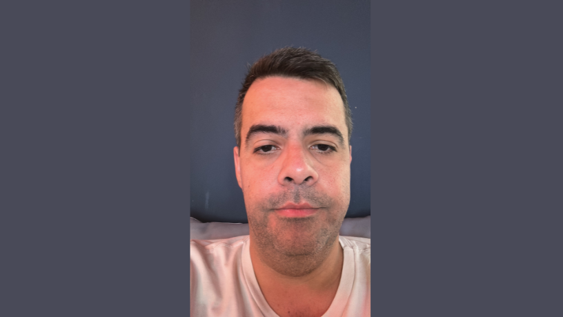 Saiba quando o histórico familiar de câncer de mama exige atenção redobrada e como Vinicius Tadeu Sattin Rodrigues orienta estratégias de acompanhamento e cuidado.